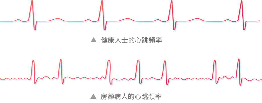 心跳1