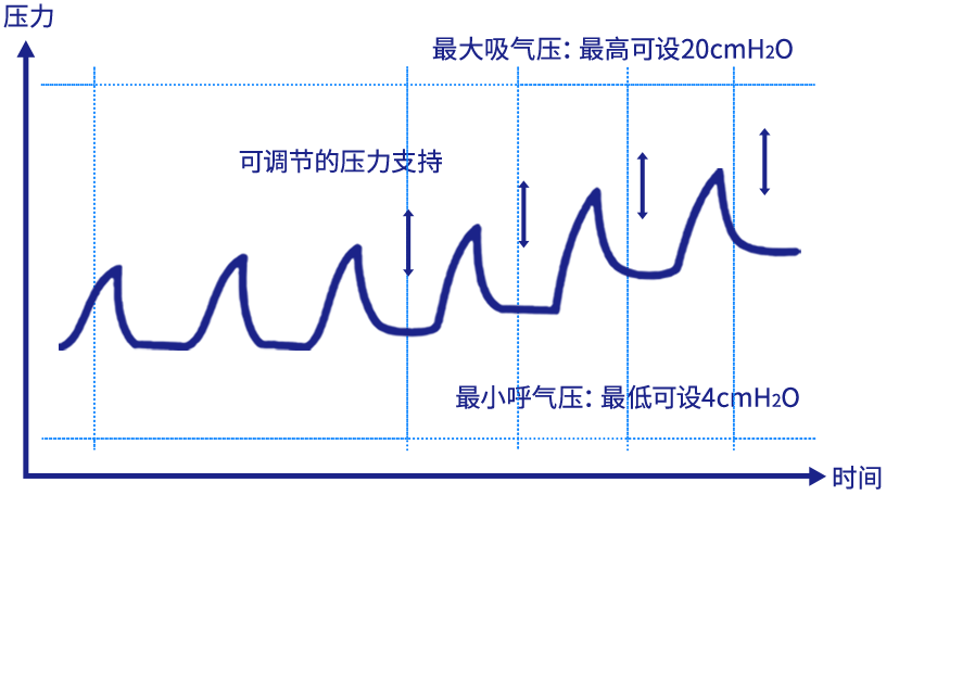 WP-S-20AS 7种睡眠与治疗压力稳定